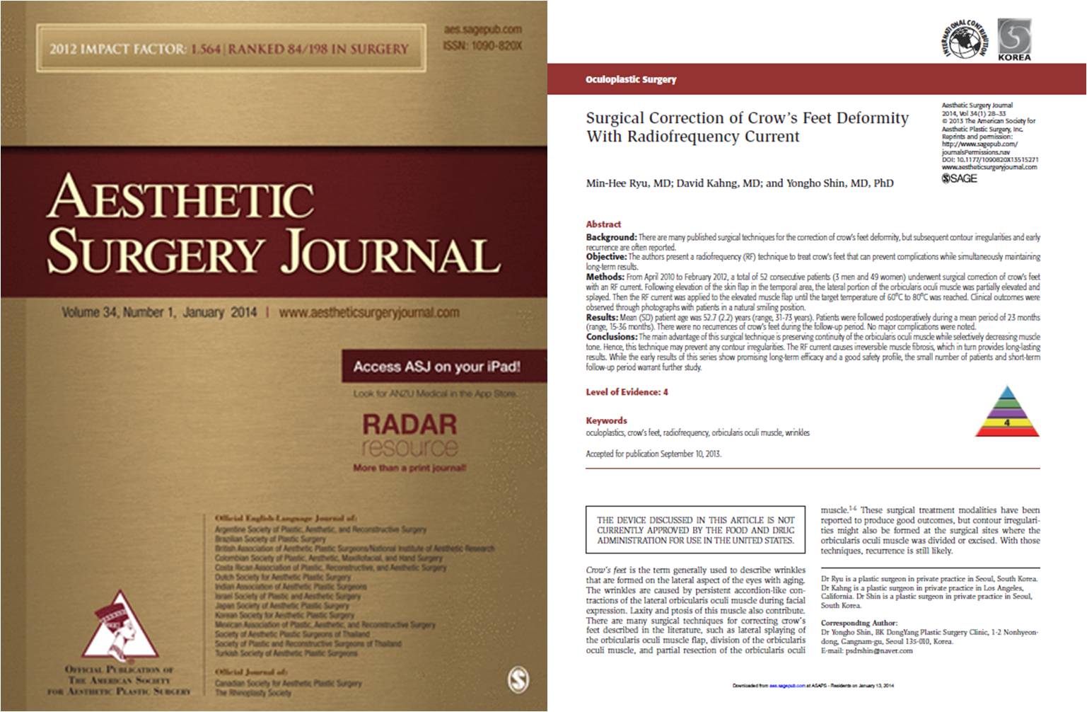 Surgical Correction of Crow's Feet Deformity With Radiofrequency Current